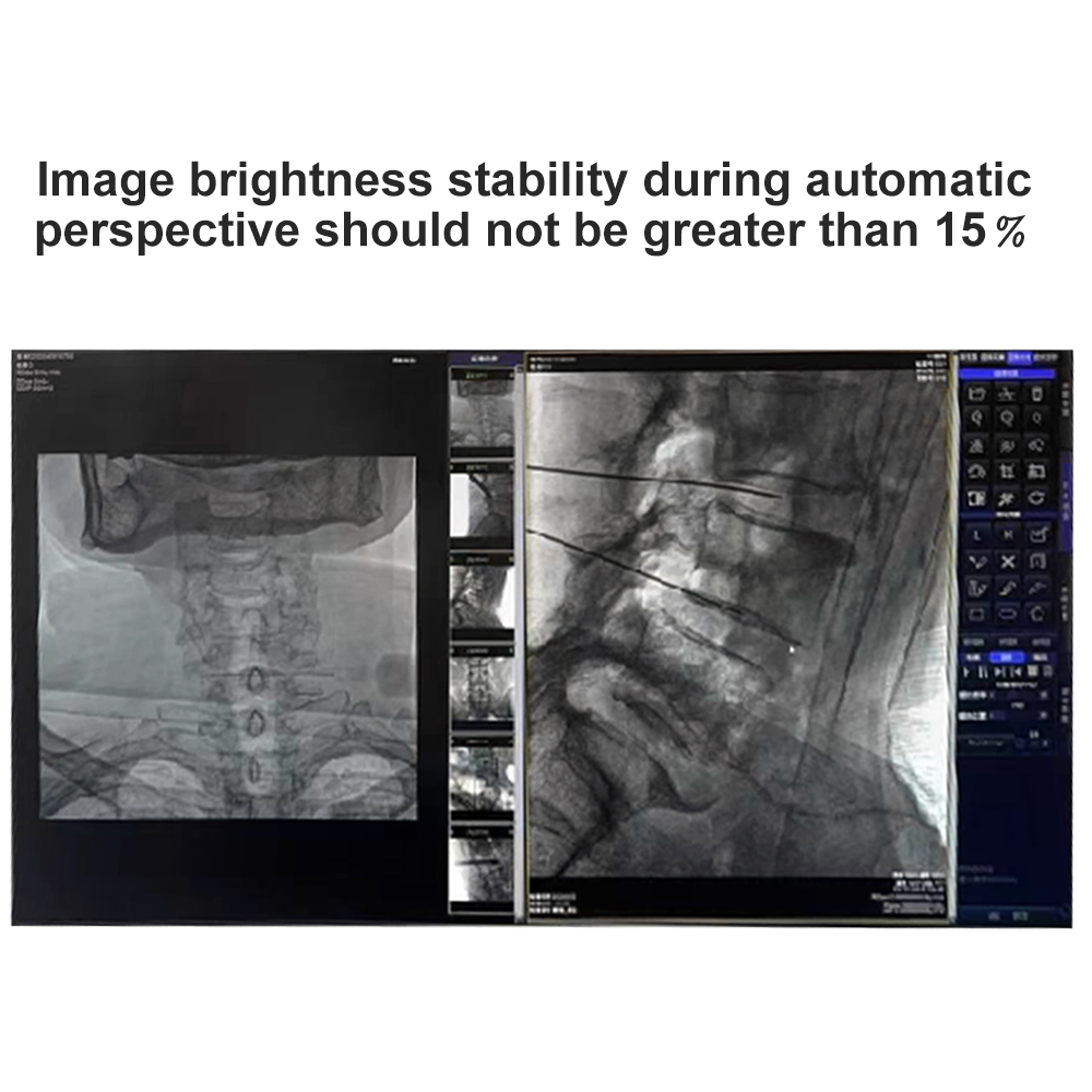 Mobile Digital C Arm System With Digital Workstation Medical Radiology C-ARM Equipment Price for Sale
