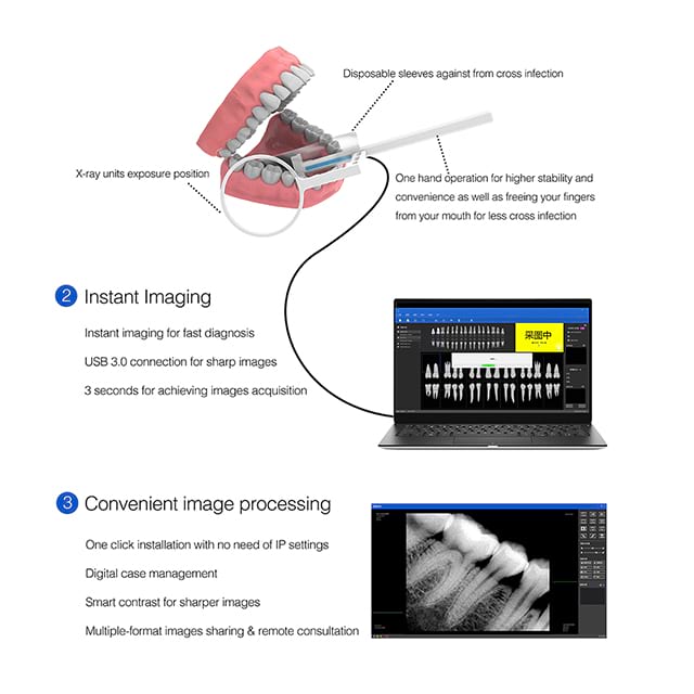 High Performance Dental X Ray Machine for Hospital MY-D042N