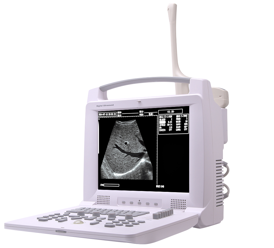 Full Digital Ultrasonic Diagnostic System Black And White Ultrasound Scan Machine Price For Human And Vet