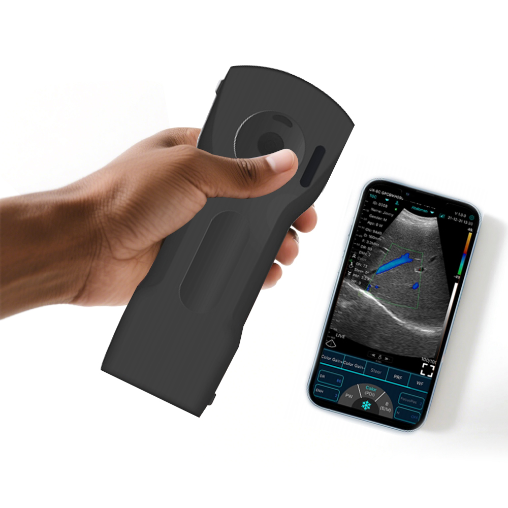 WIFI Wireless Probe 3 in 1 Convex Linear Cardiac Function Ultrasound for Ambulance