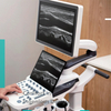 Sonoscape P9 High-Tech Electric Medical Trolley Convex 4D 3D Color Doppler Ultrasound Scanner Innovative Metal Diagnostic