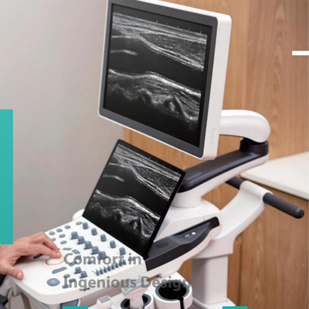 Sonoscape P9 High-Tech Electric Medical Trolley Convex 4D 3D Color Doppler Ultrasound Scanner Innovative Metal Diagnostic