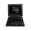 Laptop Color Doppler Ultrasound (LCUS) A024A-N 