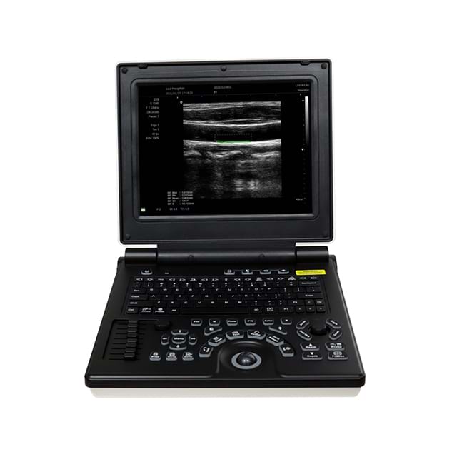 Laptop Color Doppler Ultrasound (LCUS) A024A-N 