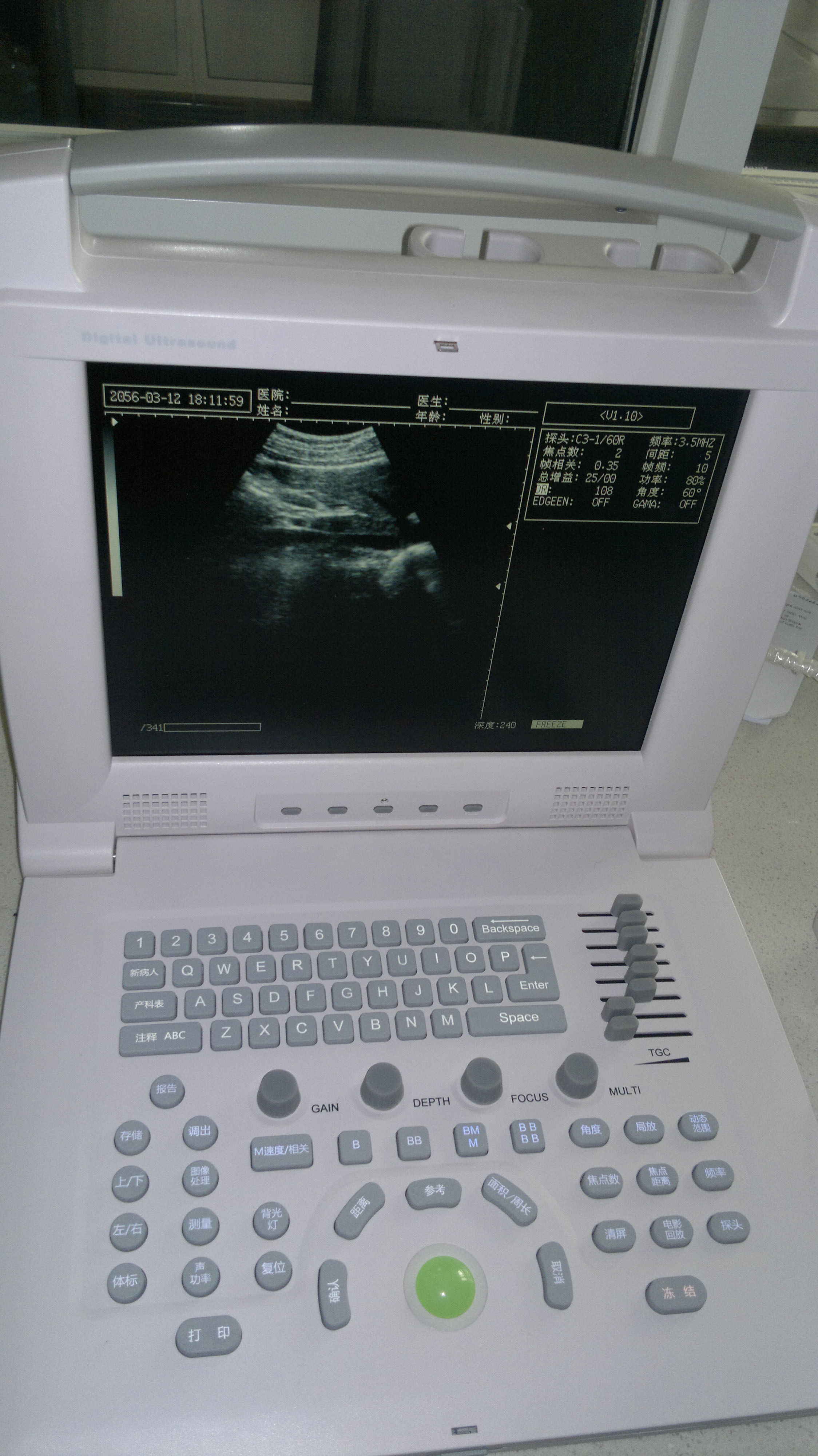 Full Digital Ultrasonic Diagnostic System Black And White Ultrasound Scan Machine Price For Human And Vet