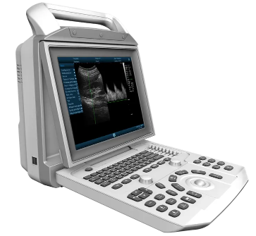 portable ultrasound machine for sale.png