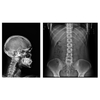 14x17 Wireless Flat Panel 1417V Wireless DR Flat Panel Detector Cassette Xray Digitizer Radiology Equipment Accessories