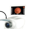 Portable Ophthalmic Equipment Full-Automatic Fundus camera Eye Fundus Camera Photography Electric Power Source