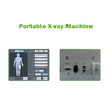 Portable X Ray Machine for Hospital D019D-N