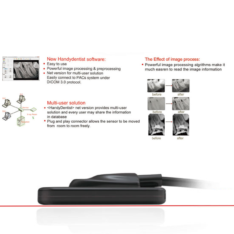 Portable Dental Xray Sensor Active Area 24x33 Wireless USB Interface ...