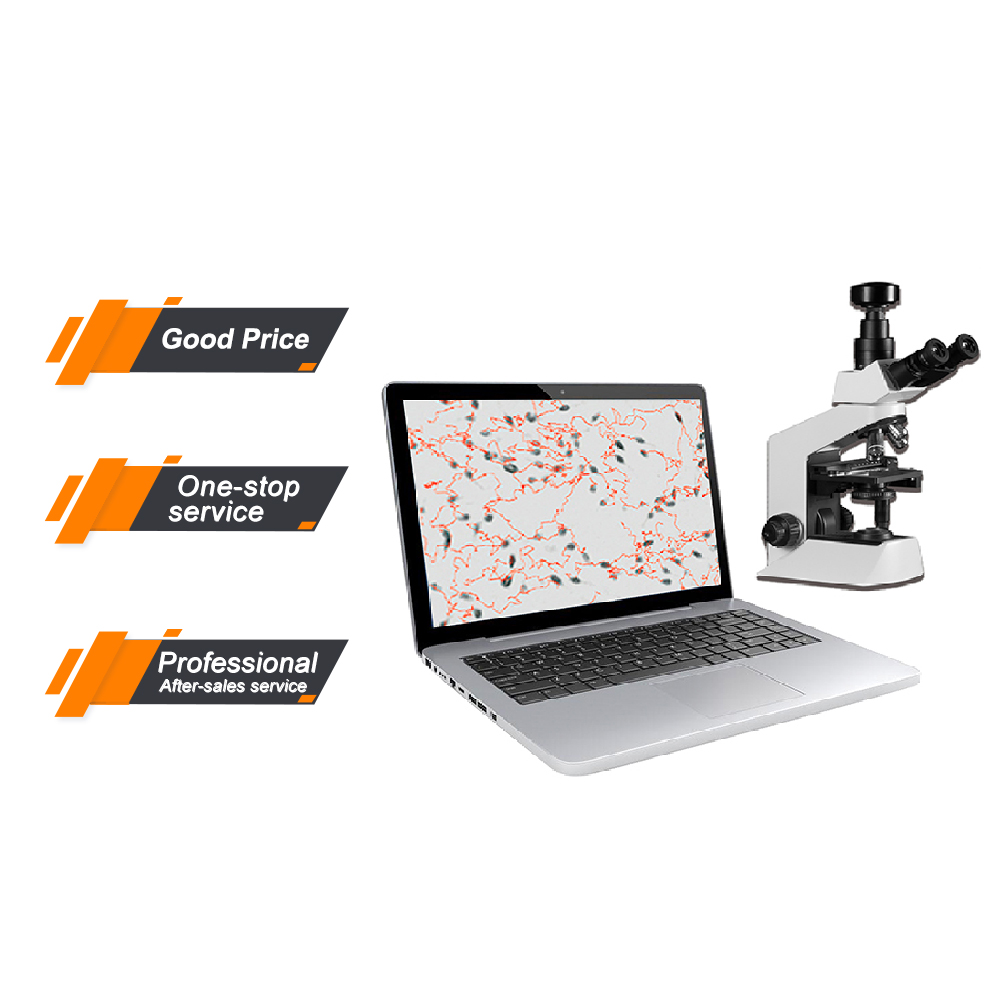 Best Price Sperm Quality Analysis System Computer Assisted Semen Machine Sperm Quality Analyzer