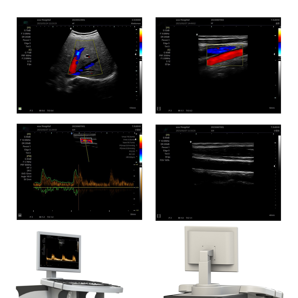 Professional Full Digital Color Doppler Ultrasonic Diagnostic System Medical ultrasound instrument ultrasound scanner price MY-A028A-B