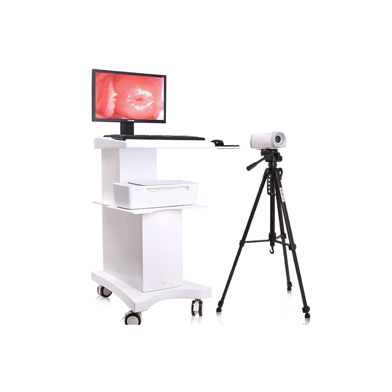 MAYAMED MY-F004 Full HD Digital Colposcope Vaginal Cervical Exam Colposcope Imaging System For Sale