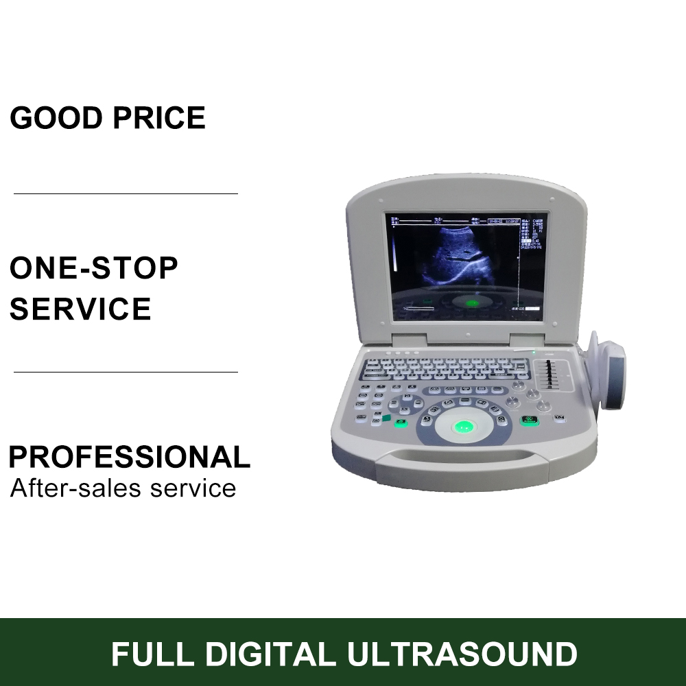 Full Digital Cheap Laptop Ultrasound Machine Device Scanner Laptop Ultrasound Device