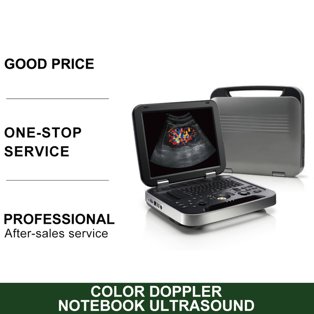 New Human Use Laptop Color Doppler Ultrasound Machine 2D 3D Echo Full Digital Ultrasound Scanner