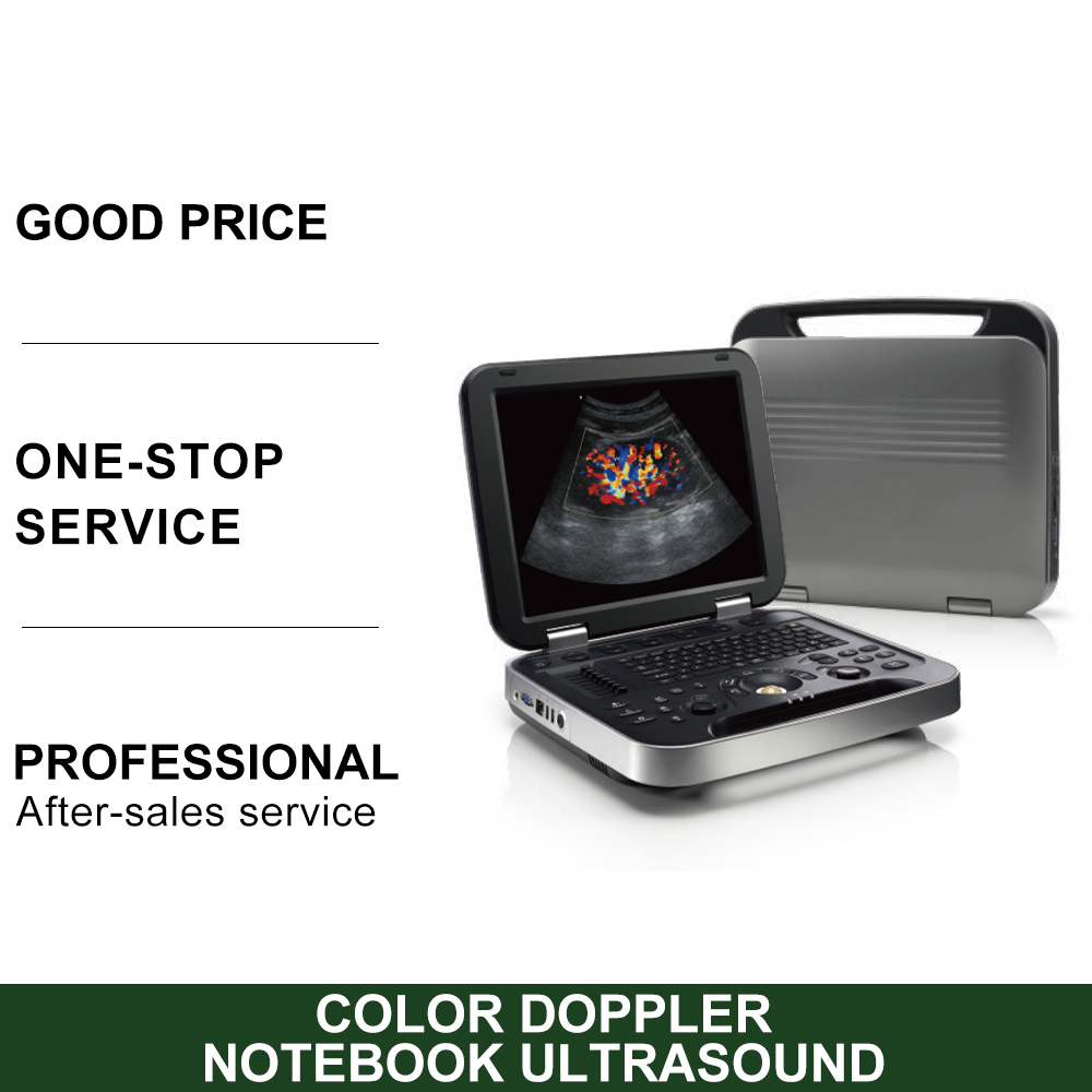 New Human Use Laptop Color Doppler Ultrasound Machine 2D 3D Echo Full Digital Ultrasound Scanner
