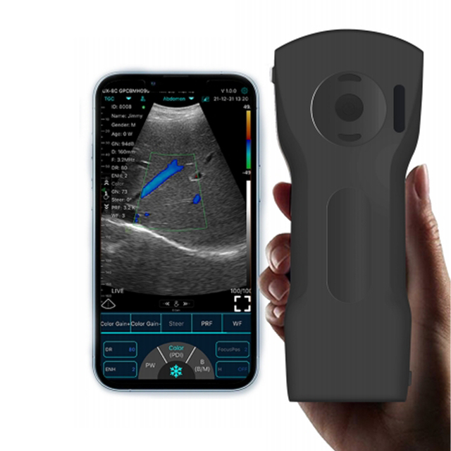 WIFI Wireless Probe 3 in 1 Convex Linear Cardiac Function Ultrasound for Ambulance