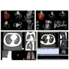 64 Slice CT Machine Medical CT Scanner Radiology Equipment Hospital Solution with CE Approval