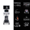 Sonoscape P9 High-Tech Electric Medical Trolley Convex 4D 3D Color Doppler Ultrasound Scanner Innovative Metal Diagnostic