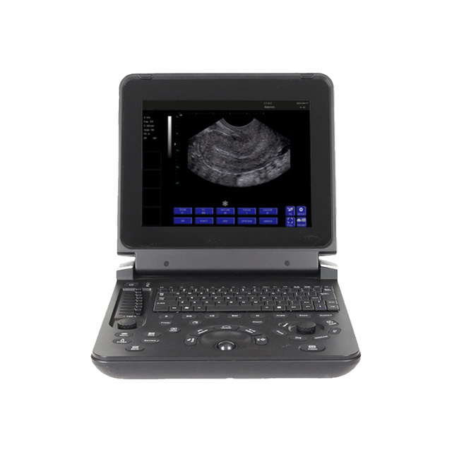  Ultrasound Probes Medical BW Laptop Ultrasound Machine With Scanner