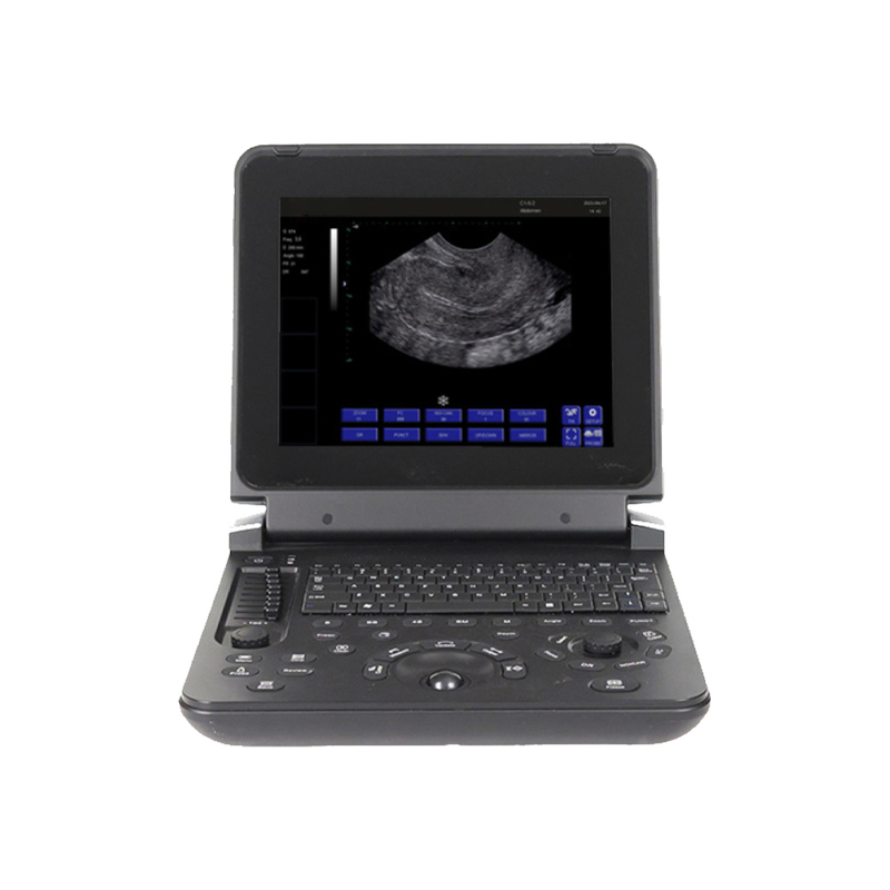  Ultrasound Probes Medical BW Laptop Ultrasound Machine With Scanner