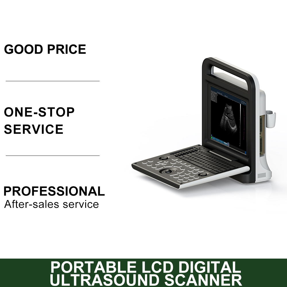 Multiple Languages Easy Operation Scanning Device Medical Portable Handheld Ultrasound Machine