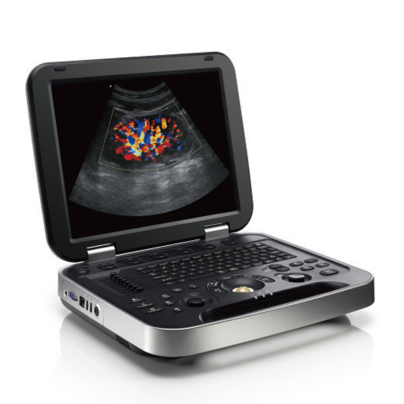 New Human Use Laptop Color Doppler Ultrasound Machine 2D 3D Echo Full Digital Ultrasound Scanner