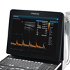 DP-50 Portable Ultrasonicay System Digital Ultrasonic Diagnostic Imaging System with Linear Probe