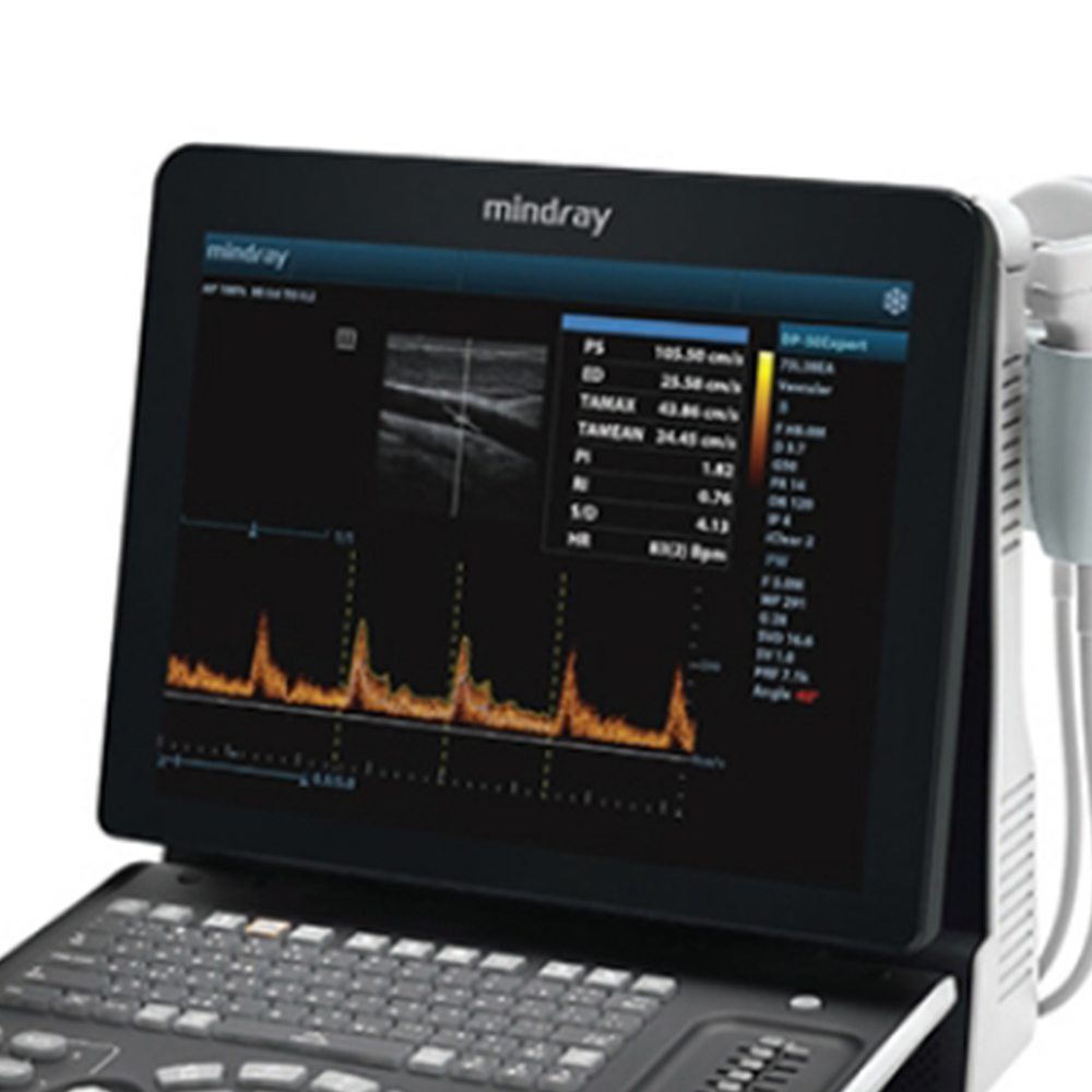 DP-50 Portable Ultrasonicay System Digital Ultrasonic Diagnostic Imaging System with Linear Probe