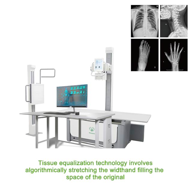 X-Ray Equipment Medical Digital Diagnostic HF X-Ray Machine D023G