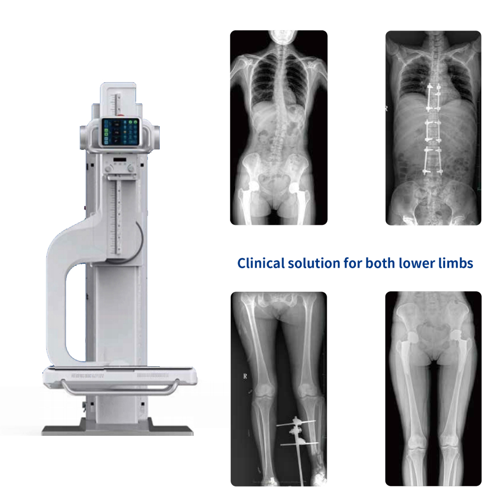 Medical Equipments Suppliers Dr System Digital X Ray Scanner Machine 300Ma X Ray Machine