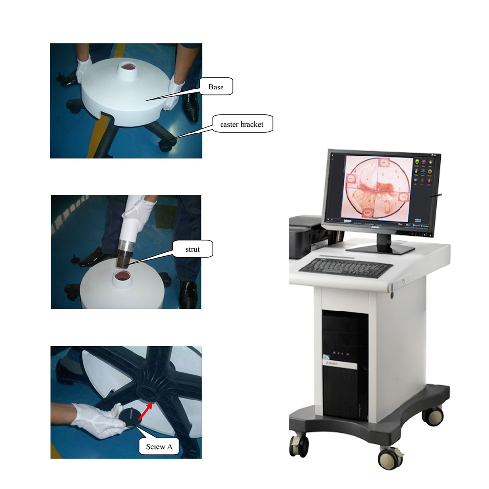 MAYAMED MY-F029 Hospital Video Colposcope Camera Gynaecology Optical Electronic Colposcope