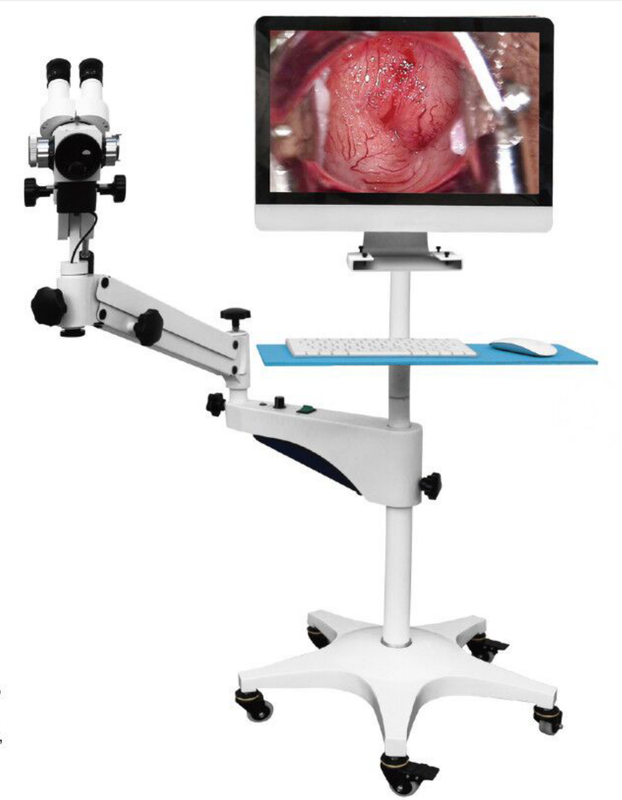 MY-F004A Trolley-type medical Digital Electronic Colposcope Video China Electronic Colposcope price for gynecology